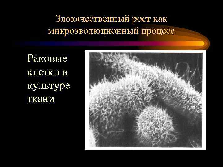 Злокачественный рост как микроэволюционный процесс Раковые клетки в культуре ткани 