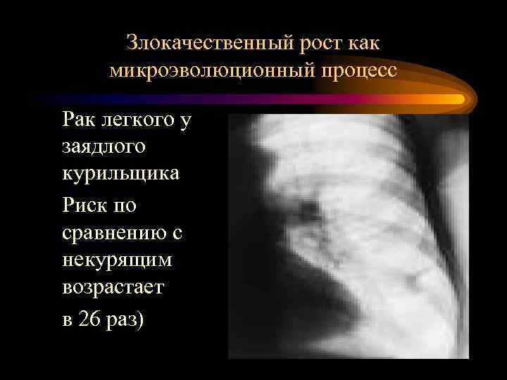 Злокачественный рост как микроэволюционный процесс Рак легкого у заядлого курильщика Риск по сравнению с