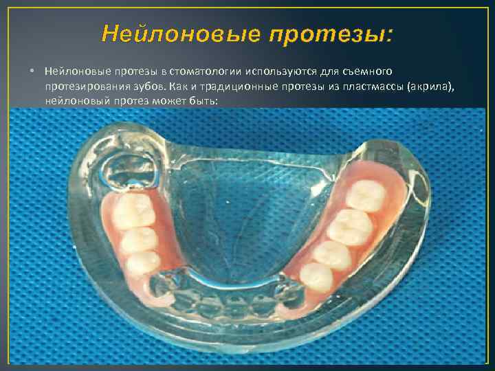 Нейлоновая пластмасса для зубных протезов. Нейлоновая пластмасса стоматология. Нейлоновый полимер для стоматологических.