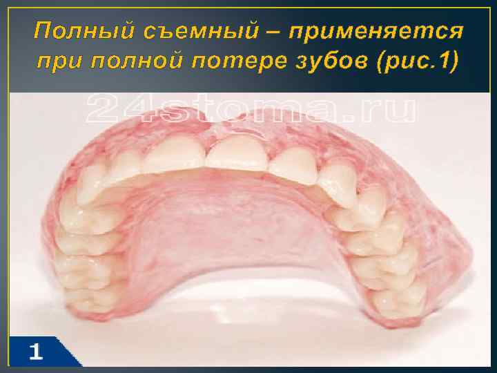 Полный съемный – применяется при полной потере зубов (рис. 1) 