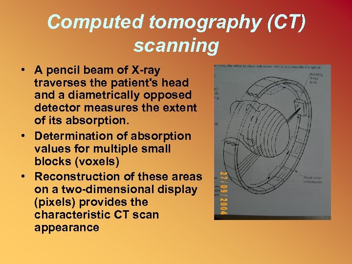 Computed tomography (CT) scanning • A pencil beam of X-ray traverses the patient's head