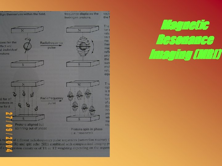 Magnetic Resonance Imaging (MRI) 