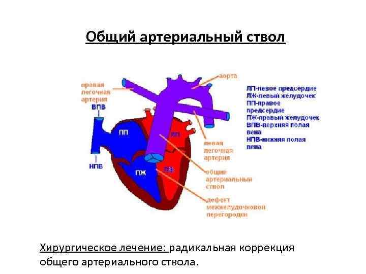 Общий артериальный ствол презентация