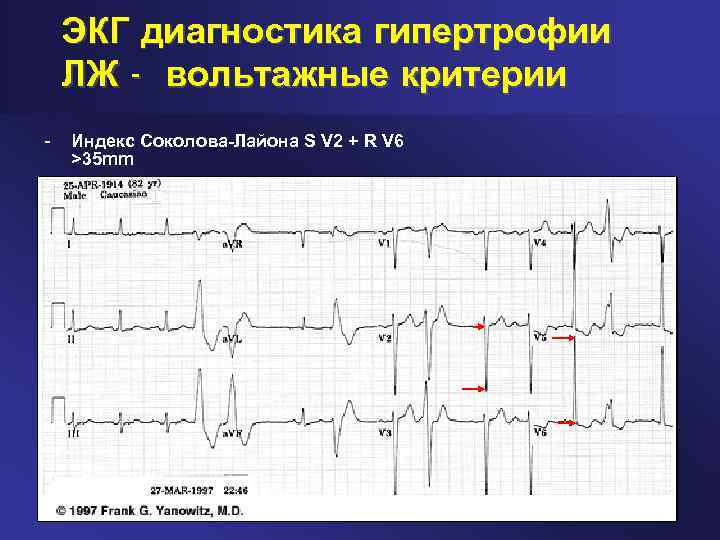 Экг диагностика