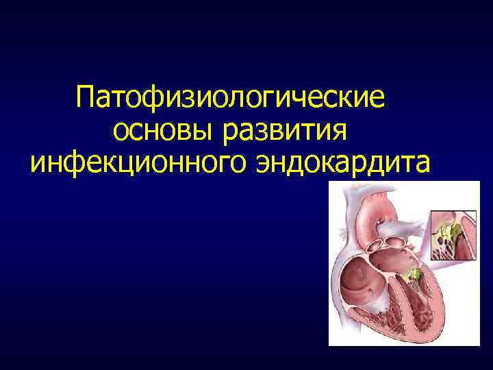 Патофизиологические основы развития инфекционного эндокардита 