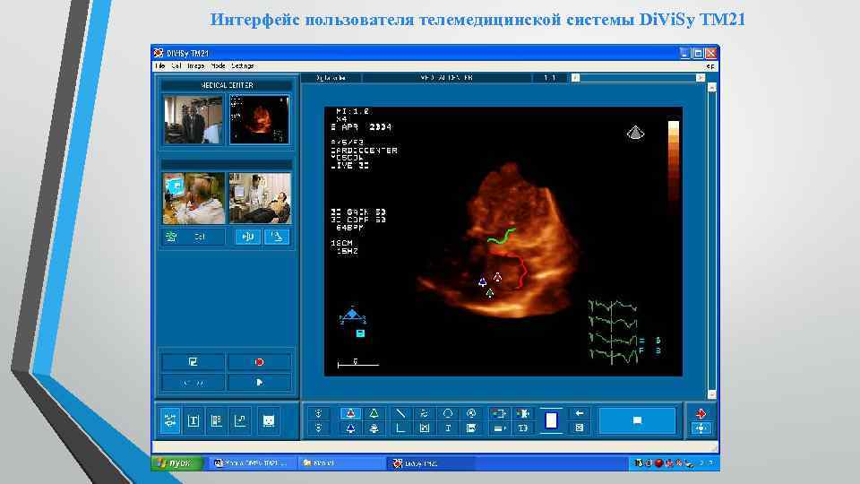 Интерфейс пользователя телемедицинской системы Di. Vi. Sy TM 21 