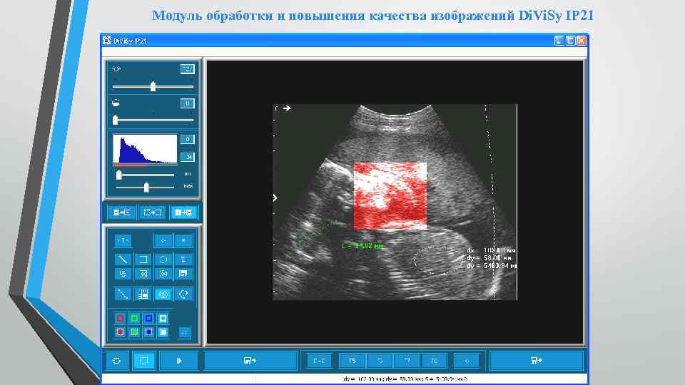 Модуль обработки и повышения качества изображений Di. Vi. Sy IP 21 
