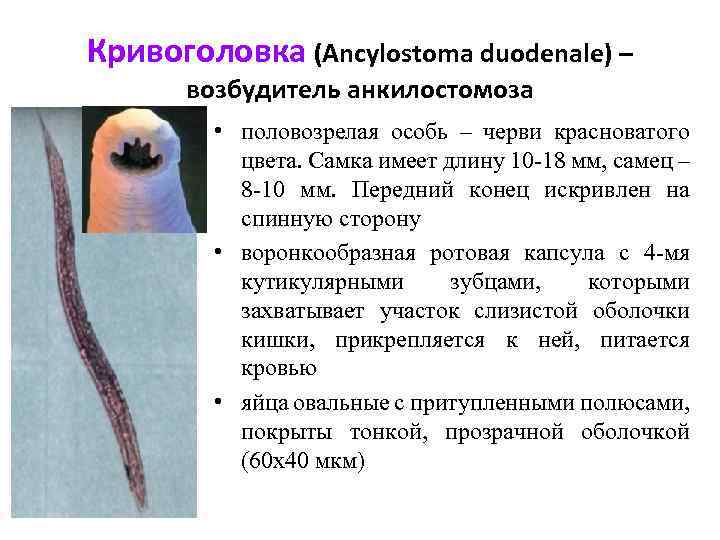 Кривоголовка (Ancylostoma duodenale) – возбудитель анкилостомоза • половозрелая особь – черви красноватого цвета. Самка