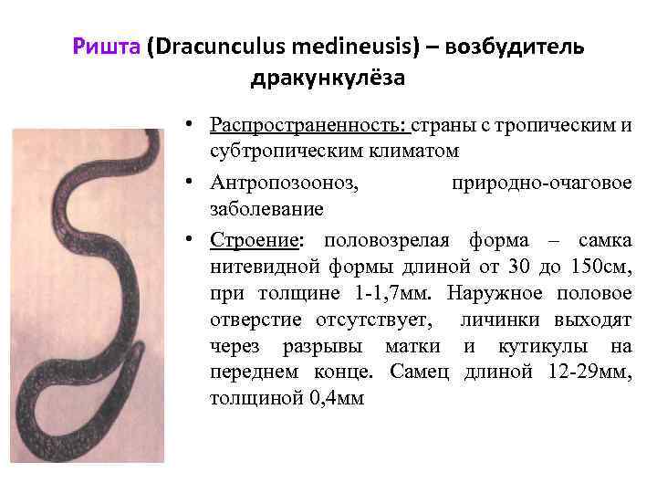 Ришта (Dracunculus medineusis) – возбудитель дракункулёза • Распространенность: страны с тропическим и субтропическим климатом