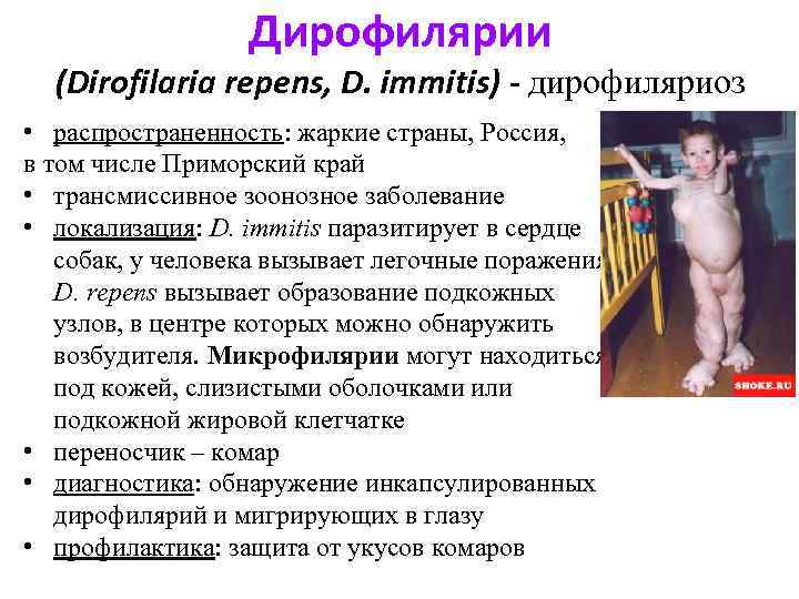 Дирофилярии (Dirofilaria repens, D. immitis) - дирофиляриоз • распространенность: жаркие страны, Россия, в том