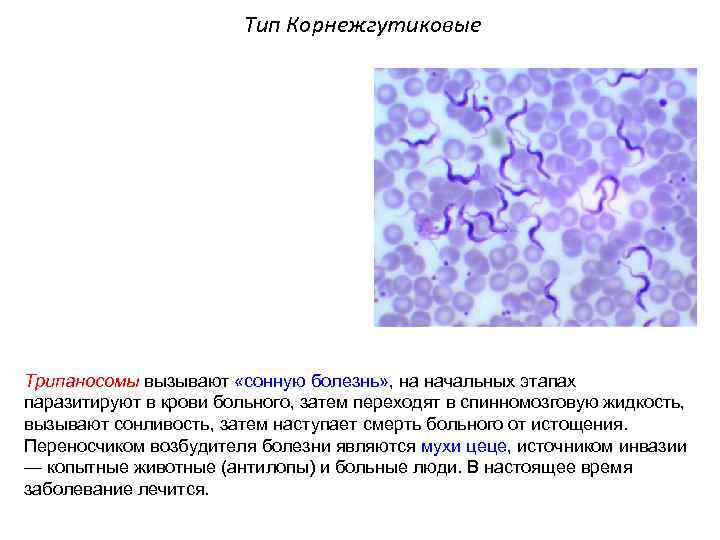 Тип Корнежгутиковые Трипаносомы вызывают «сонную болезнь» , на начальных этапах паразитируют в крови больного,
