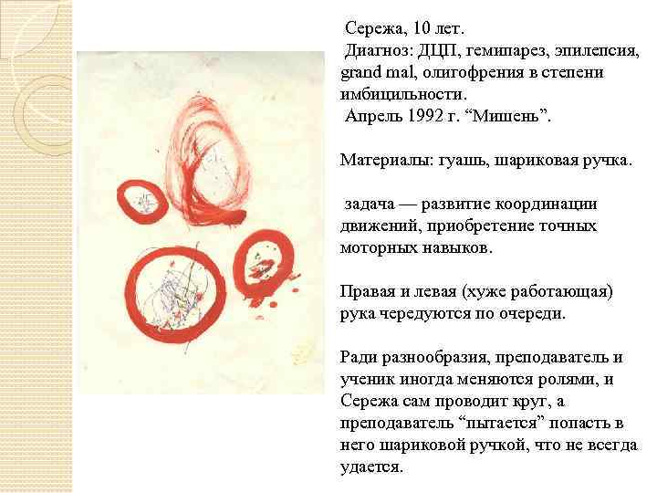  Сережа, 10 лет. Диагноз: ДЦП, гемипарез, эпилепсия, grand mal, олигофрения в степени имбицильности.