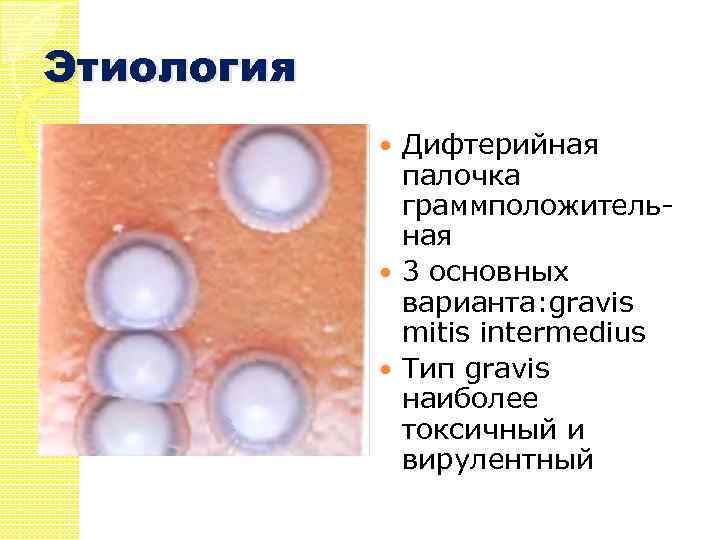 Этиология Дифтерийная палочка граммположительная 3 основных варианта: gravis mitis intermedius Тип gravis наиболее токсичный