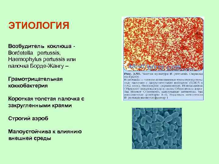 ЭТИОЛОГИЯ Возбудитель коклюша Bordetella pertussis, Нaemophylus pertussis или палочка Борде-Жангу – Грамотрицательная коккобактерия Короткая