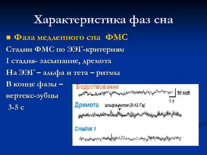 Характеристика фаз сна n Фаза медленного сна ФМС Стадии ФМС по ЭЭГ-критериям I стадия-
