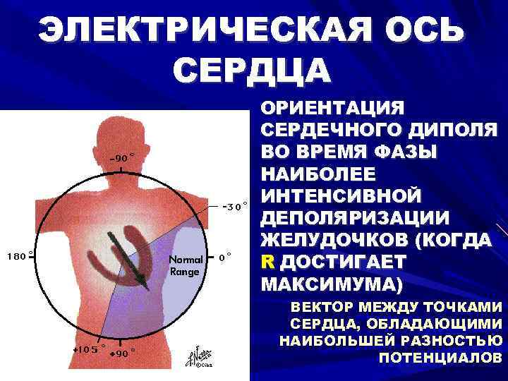 ЭЛЕКТРИЧЕСКАЯ ОСЬ СЕРДЦА ОРИЕНТАЦИЯ СЕРДЕЧНОГО ДИПОЛЯ ВО ВРЕМЯ ФАЗЫ НАИБОЛЕЕ ИНТЕНСИВНОЙ ДЕПОЛЯРИЗАЦИИ ЖЕЛУДОЧКОВ (КОГДА