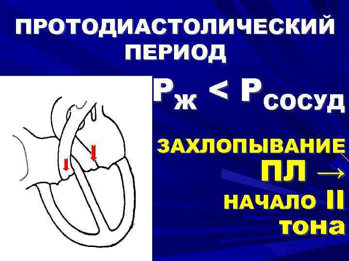 ПРОТОДИАСТОЛИЧЕСКИЙ ПЕРИОД PЖ < PСОСУД ЗАХЛОПЫВАНИЕ ПЛ → II тона НАЧАЛО 