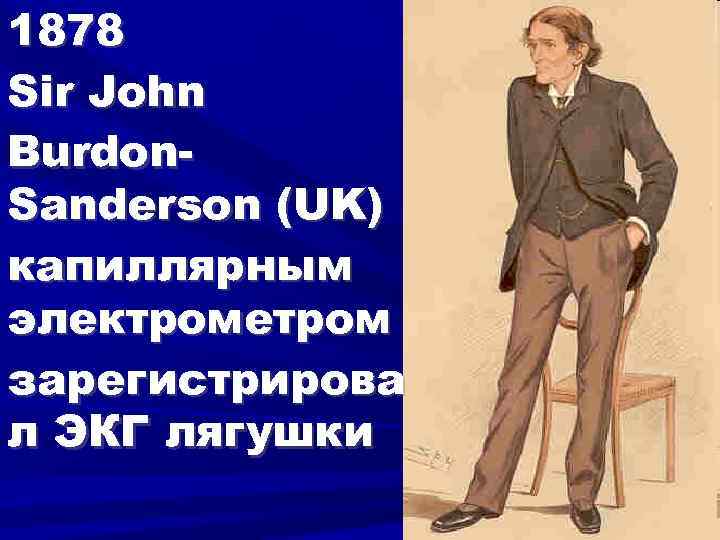 1878 Sir John Burdon. Sanderson (UK) капиллярным электрометром зарегистрирова л ЭКГ лягушки 