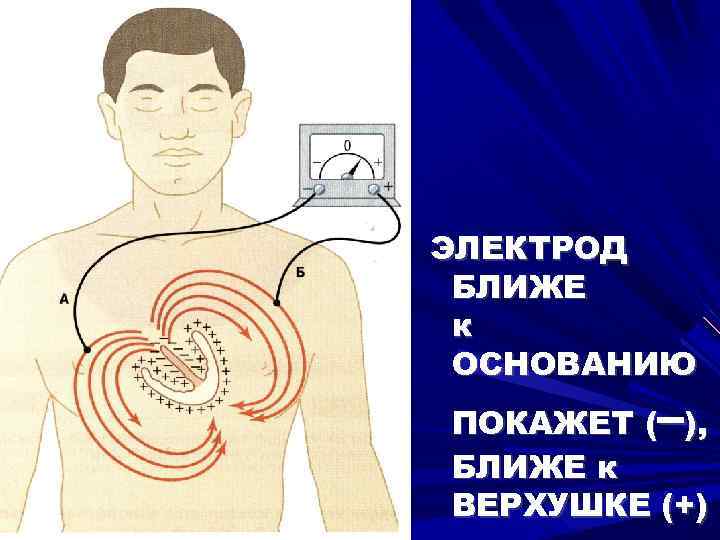 ЭЛЕКТРОД БЛИЖЕ к ОСНОВАНИЮ – ПОКАЖЕТ ( ), БЛИЖЕ к ВЕРХУШКЕ (+) 
