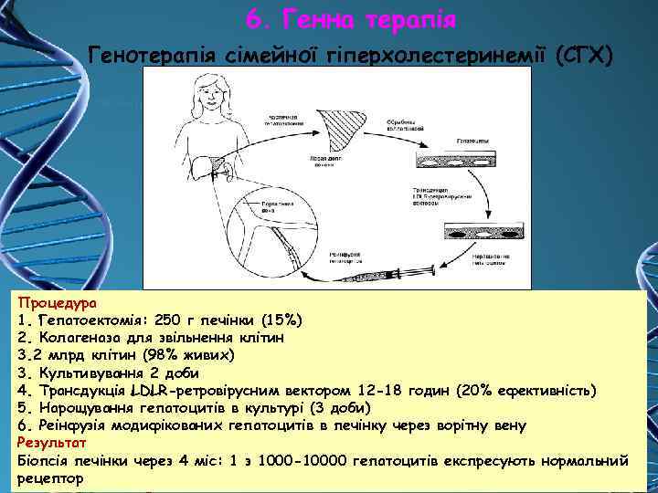 6. Генна терапія Генотерапія сімейної гіперхолестеринемії (СГХ) Процедура 1. Гепатоектомія: 250 г печінки (15%)