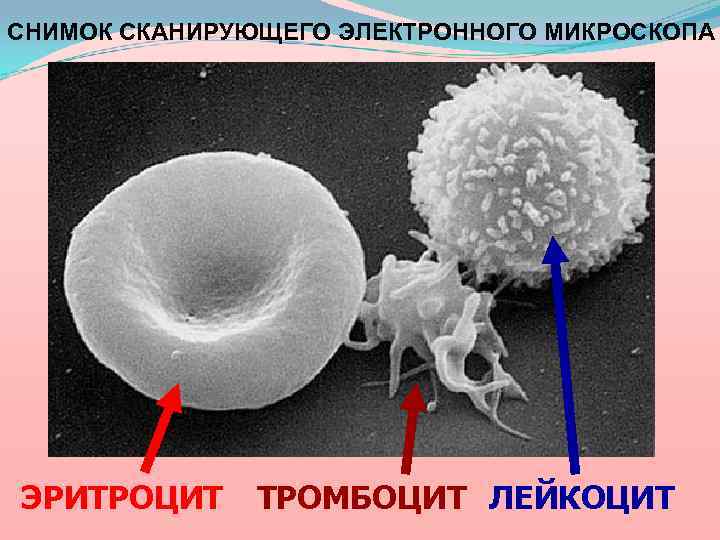 СНИМОК СКАНИРУЮЩЕГО ЭЛЕКТРОННОГО МИКРОСКОПА ЭРИТРОЦИТ ТРОМБОЦИТ ЛЕЙКОЦИТ 
