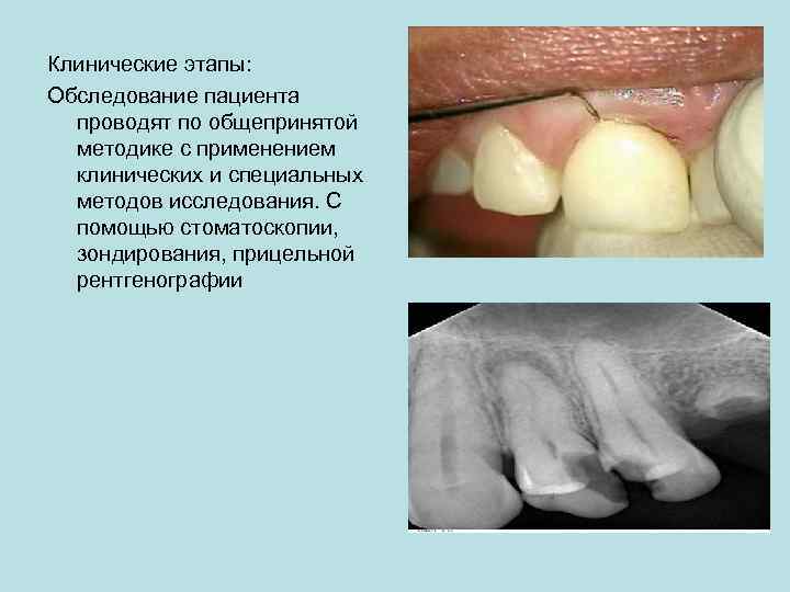 Клинические этапы: Обследование пациента проводят по общепринятой методике с применением клинических и специальных методов
