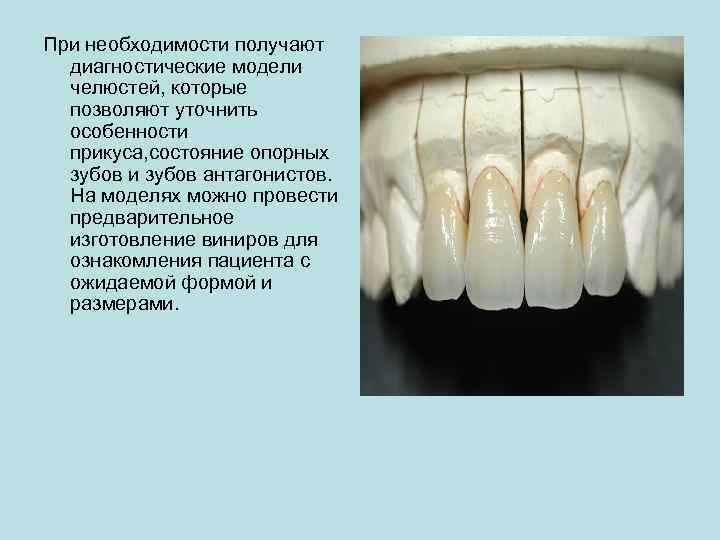 При необходимости получают диагностические модели челюстей, которые позволяют уточнить особенности прикуса, состояние опорных зубов