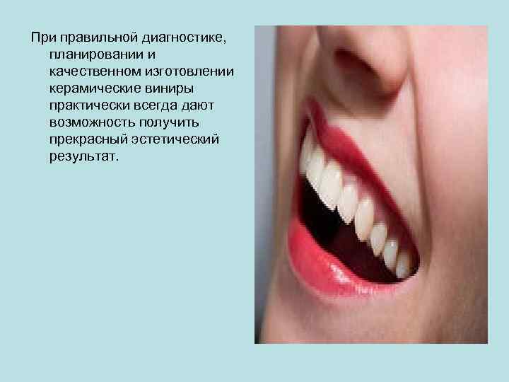 При правильной диагностике, планировании и качественном изготовлении керамические виниры практически всегда дают возможность получить