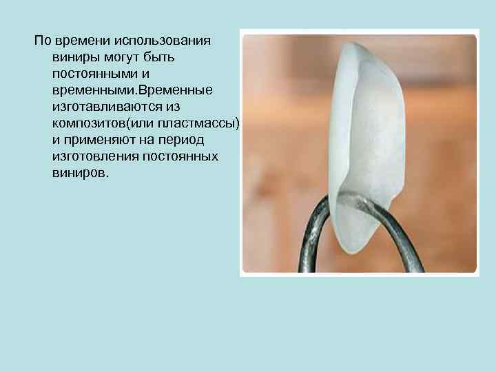 По времени использования виниры могут быть постоянными и временными. Временные изготавливаются из композитов(или пластмассы)