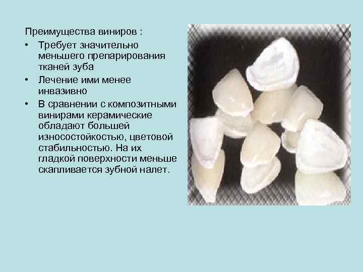 Преимущества виниров : • Требует значительно меньшего препарирования тканей зуба • Лечение ими менее
