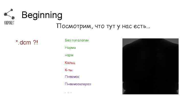 Beginning Посмотрим, что тут у нас есть… *. dcm ? ! Без патологии Норма