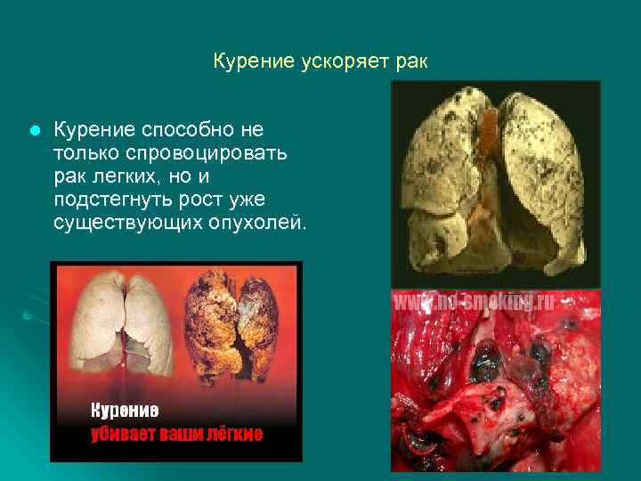 Курение ускоряет рак l Курение способно не только спровоцировать рак легких, но и подстегнуть