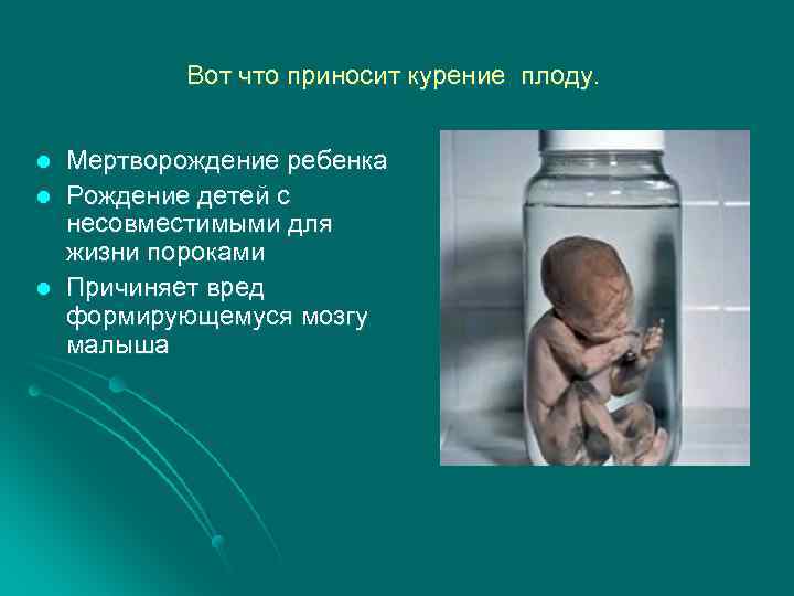Вот что приносит курение плоду. l l l Мертворождение ребенка Рождение детей с несовместимыми