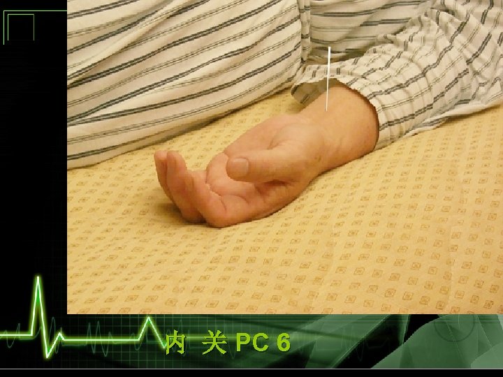 内 关 PC 6 