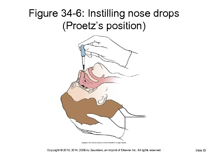 Figure 34 -6: Instilling nose drops (Proetz’s position) Copyright © 2018, 2014, 2009 by