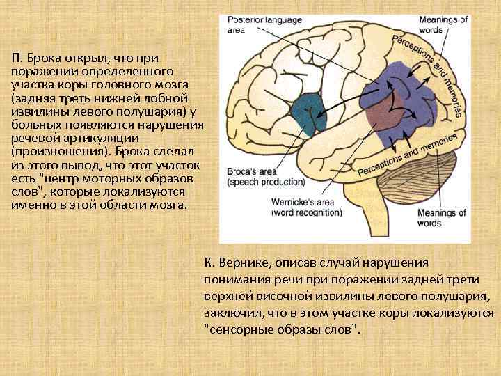 В переднем мозге полушария отсутствуют. Речевые структуры мозга. Нарушения речи при поражении коры головного мозга. Речевые центры коры головного мозга. Речевые зоны коры головного мозга.