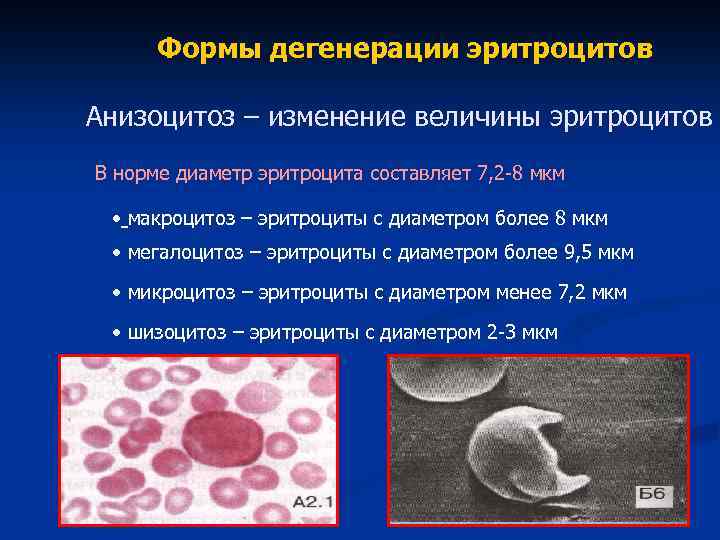 Посмотрите на изображение эритроцитов в разной среде в каком растворе находятся