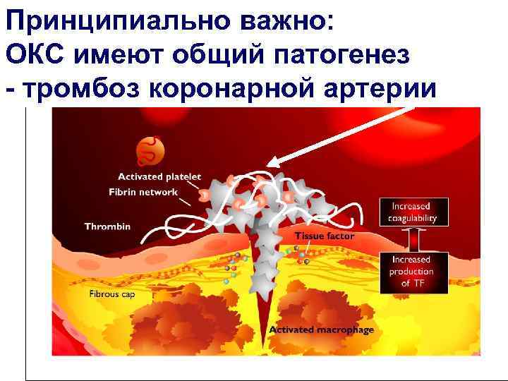 Механизм тромбоза