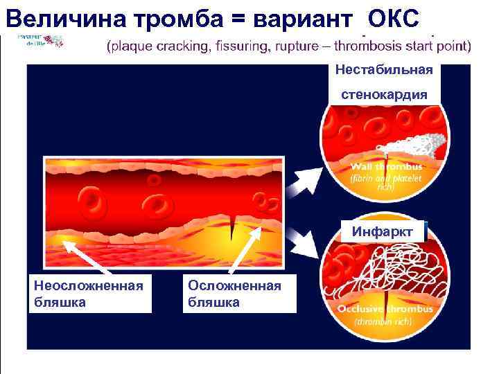 Варианты окс