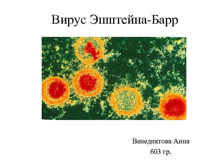 Вирус Эпштейна-Барр Венедиктова Анна 603 гр. 