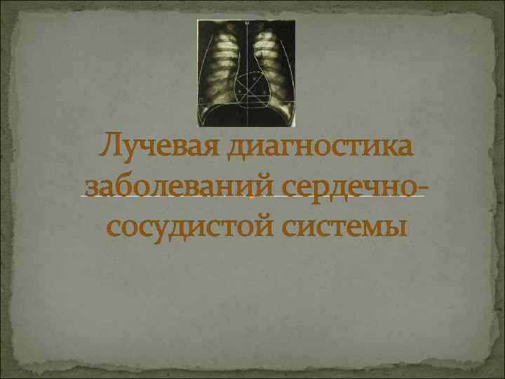 Лучевая диагностика заболеваний сердечнососудистой системы 