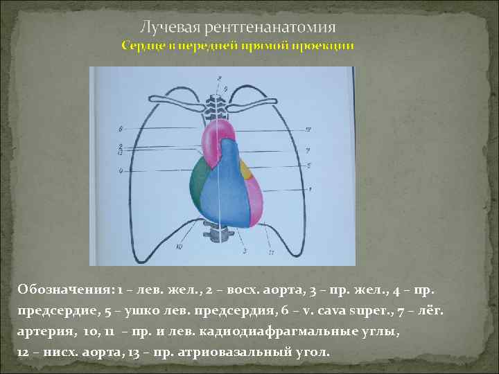 Обозначения: 1 – лев. жел. , 2 – восх. аорта, 3 – пр. жел.