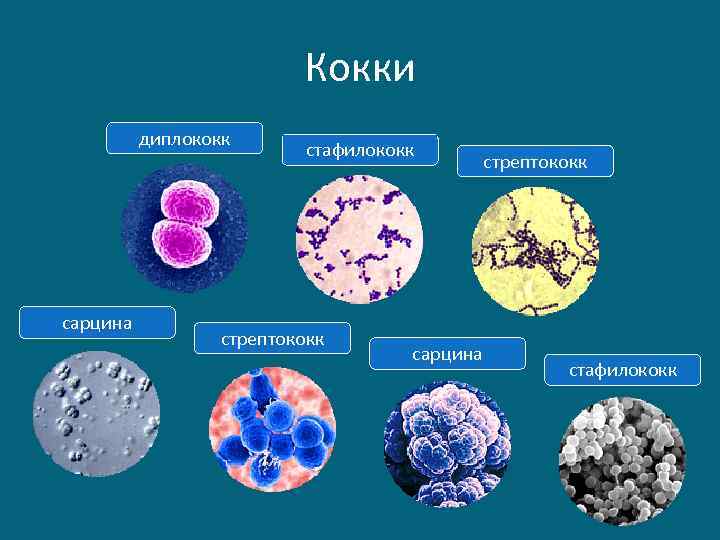 Кокки диплококк сарцина стафилококк стрептококк сарцина стрептококк стафилококк 