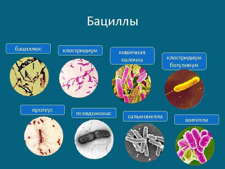 Бациллы бациллюс протеус клостридиум псевдомонас кишечная палочка сальмонелла клостридиум ботулинум шигелла 