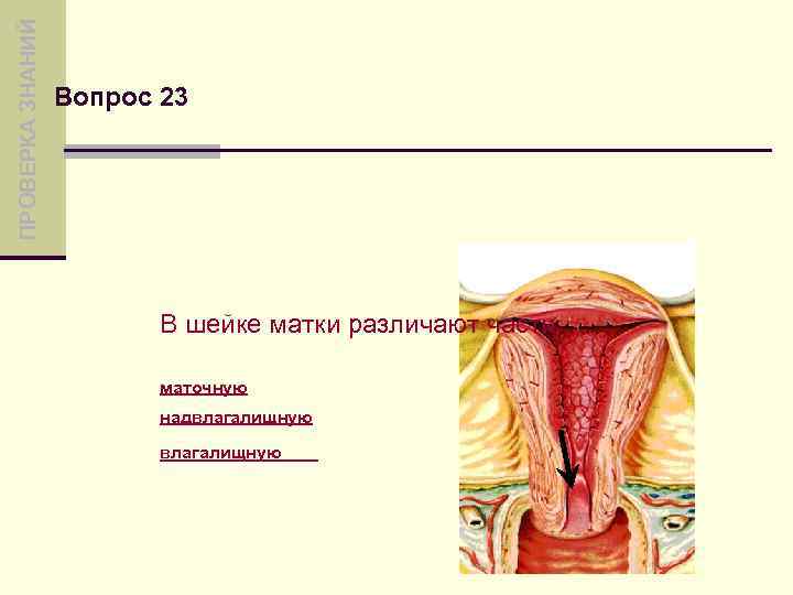ПРОВЕРКА ЗНАНИЙ Вопрос 23 В шейке матки различают части: маточную надвлагалищную 