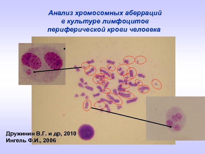 Анализ хромосомных аберраций в культуре лимфоцитов периферической крови человека Дружинин В. Г. и др,