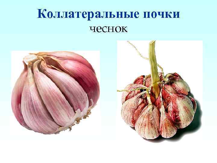 Придаточные почки фото