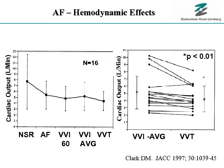 N=16 NSR AF VVI 60 VVI VVT AVG *p < 0. 01 Cardiac Output