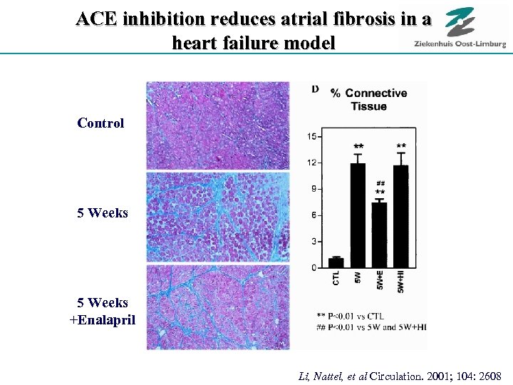ACE inhibition reduces atrial fibrosis in a heart failure model Control 5 Weeks +Enalapril