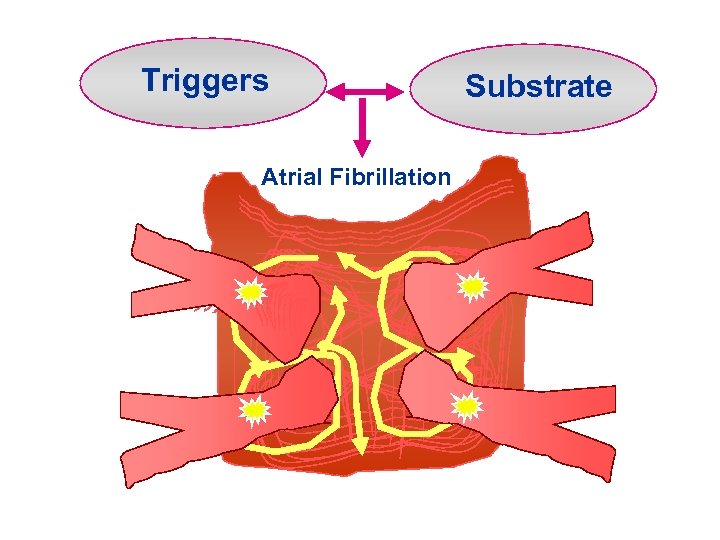 Triggers Atrial Fibrillation Substrate 